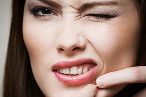 treat acne scars naturally