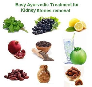 natural remedy ayurvedic-treatment-for-kidney-stones-removal 98rt kidney stones herbal house cures
